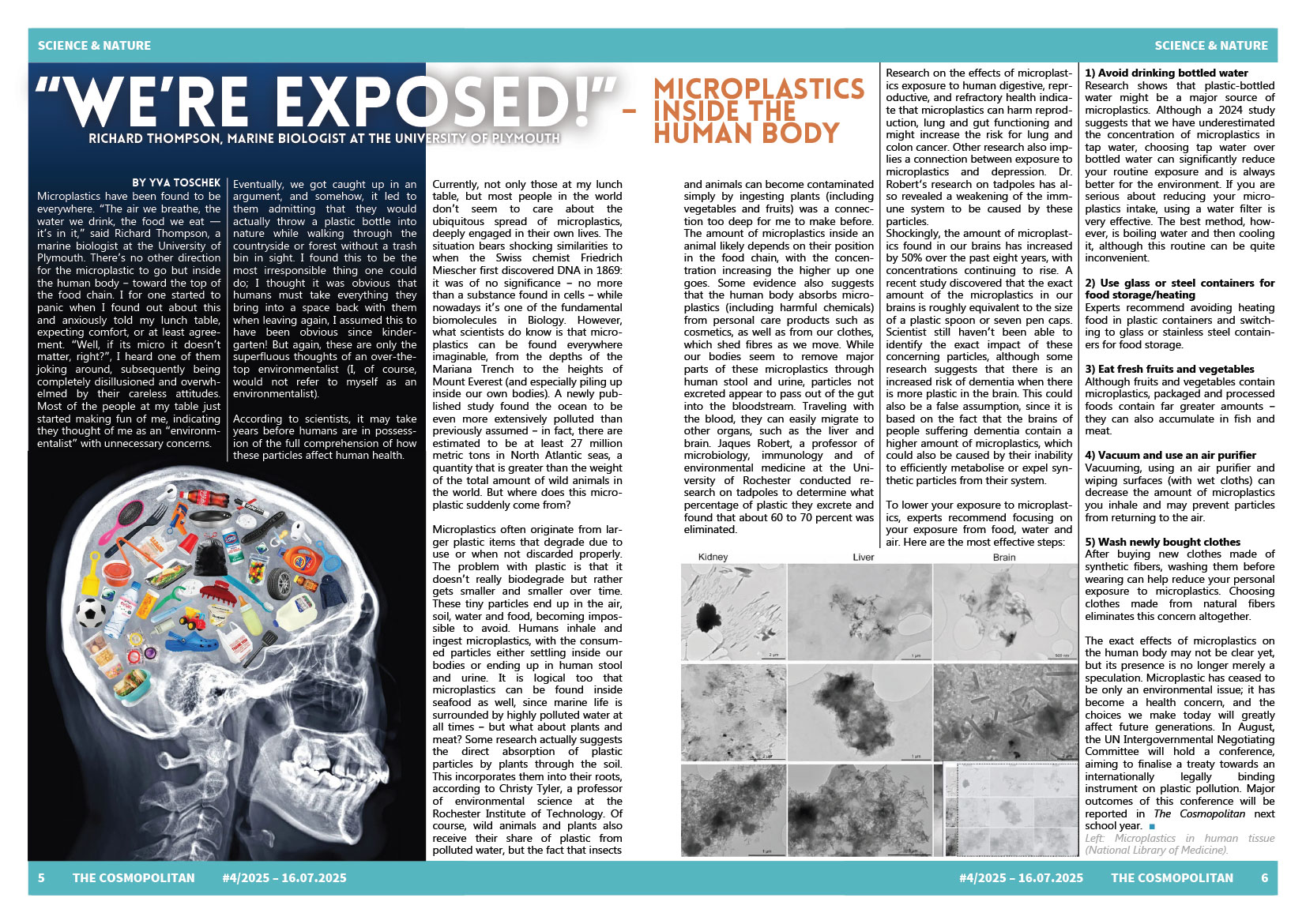 Cosmopolitanschool Berlin Eine Magazinseite mit einem Artikel über Mikroplastik, der eine Röntgenaufnahme des menschlichen Kopfes mit Plastikmüll darin zeigt. Die Seiten haben Textspalten, mikroskopische Bilder und hervorgehobene Abschnitte in Blau und Orange.